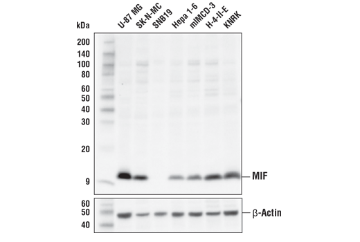 Western Blotting Image 1: MIF Antibody