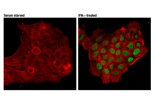 undefined Image 24: Microglia Cross Module Antibody Sampler Kit