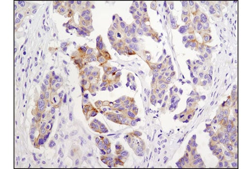 Immunohistochemistry Image 2: N-Cadherin (D4R1H) XP<sup>®</sup> Rabbit mAb