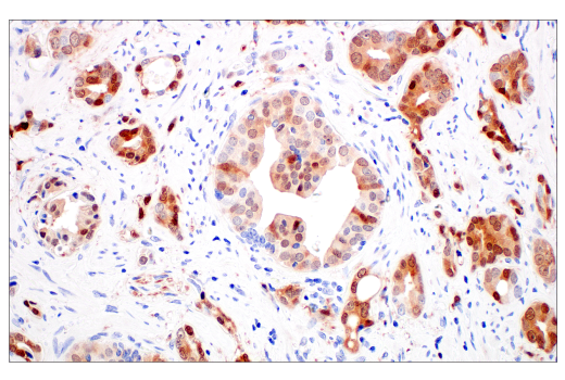 Immunohistochemistry Image 3: p16 INK4A (BC42) Mouse mAb