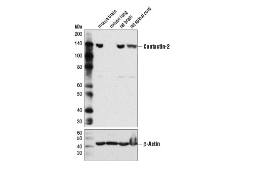 Western Blotting Image 1: Contactin-2 (D4M7G) Rabbit mAb