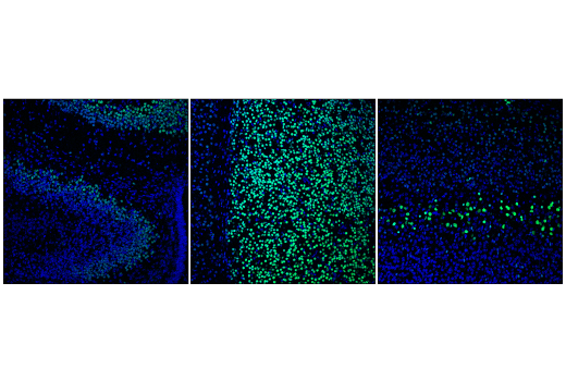 Immunofluorescence Image 1: Bcl-11B (D6F1) XP<sup>®</sup> Rabbit mAb (BSA and Azide Free)