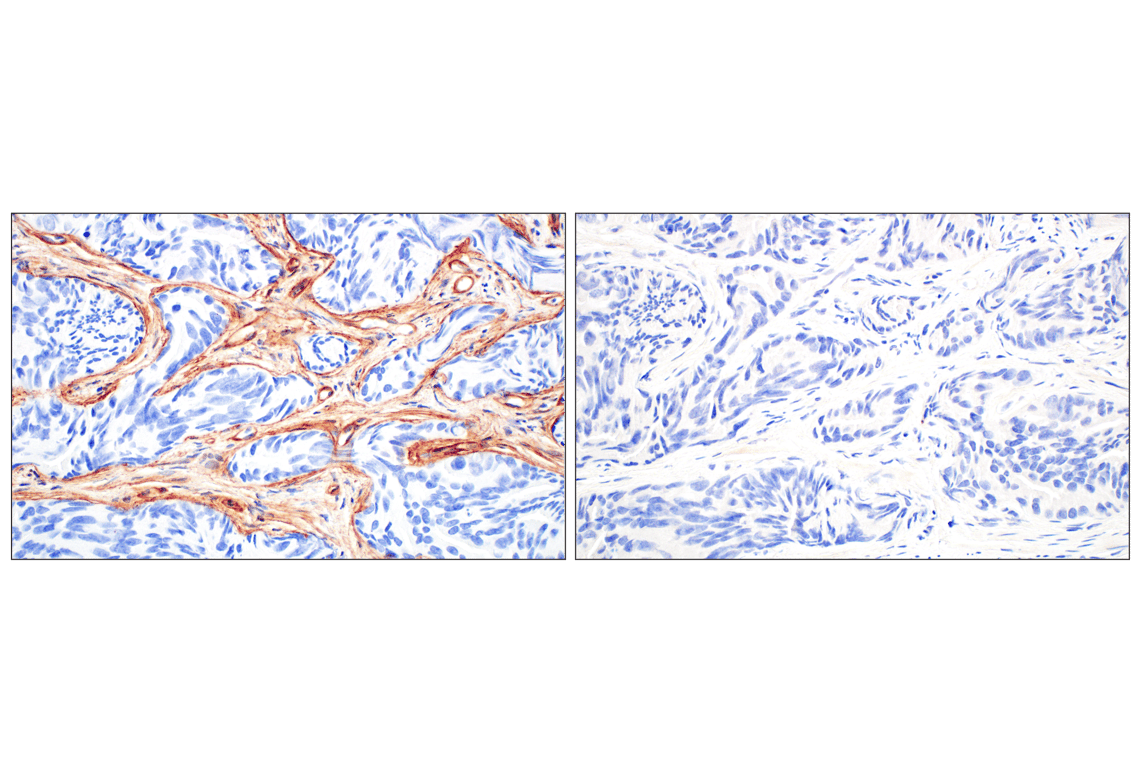 Immunohistochemistry Image 8: COL4A1 (E5M6R) Rabbit mAb (BSA and Azide Free)