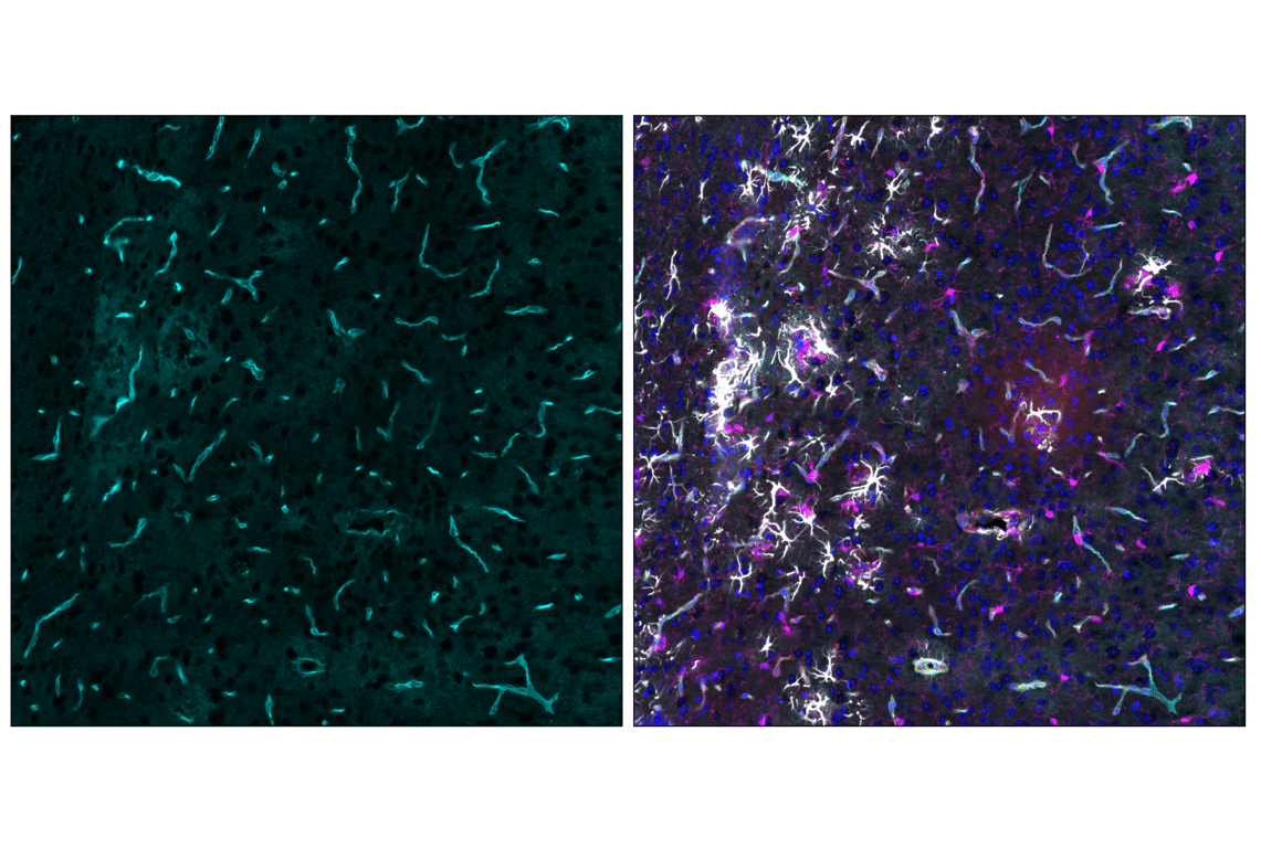 Immunofluorescence Image 6: AQP4 (D1F8E) XP<sup>®</sup> Rabbit mAb (Alexa Fluor<sup>®</sup> 647 Conjugate)