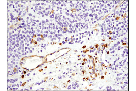 Immunohistochemistry Image 3: VISTA (D1L2G<sup>™</sup>) XP<sup>®</sup> Rabbit mAb (BSA and Azide Free)