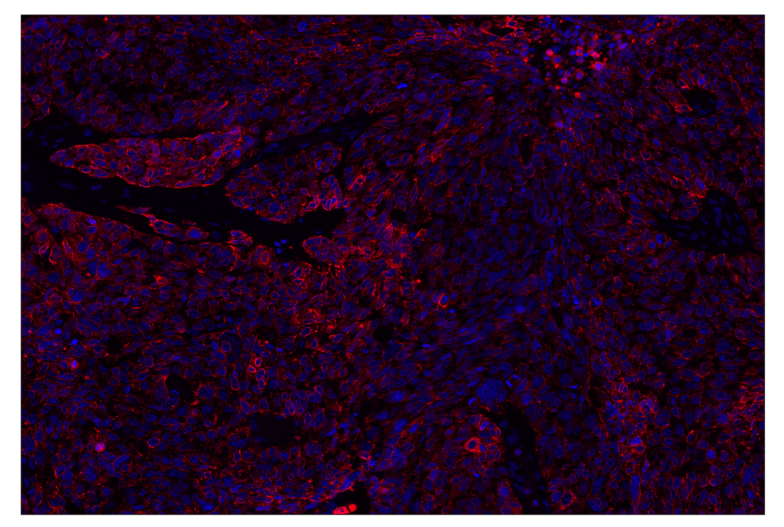 Immunohistochemistry Image 1: Keratin 17/19 (D4G2) XP® Rabbit mAb (Alexa Fluor® 555 Conjugate)