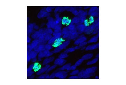 undefined Image 13: Aurora A/B Substrate Antibody Sampler Kit