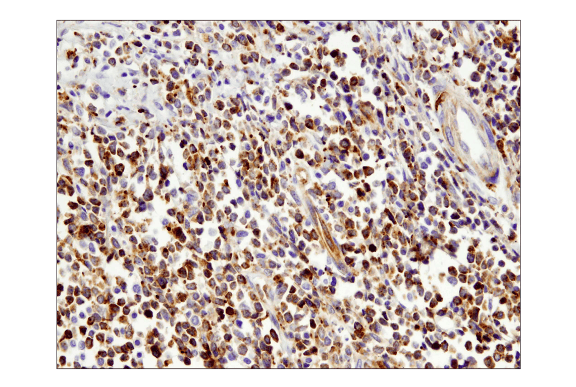Immunohistochemistry Image 2: VISTA (D1L2G<sup>™</sup>) XP<sup>®</sup> Rabbit mAb