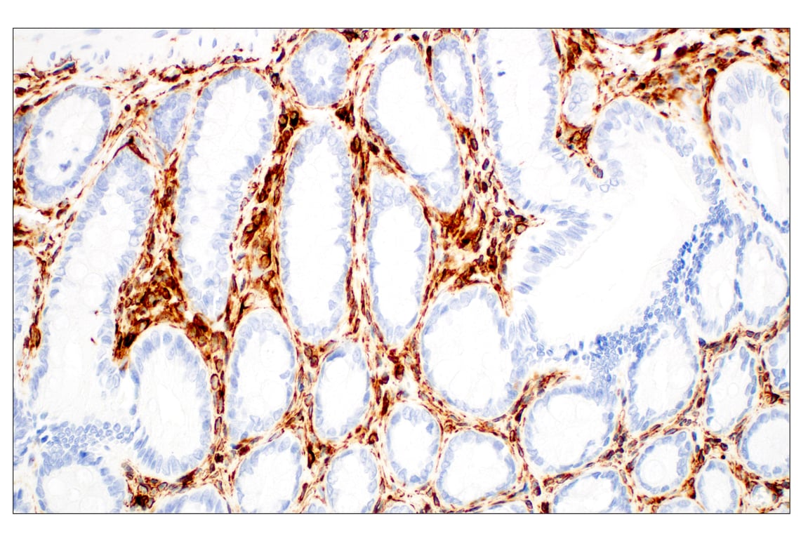 undefined Image 39: Cell Fractionation Antibody Sampler Kit