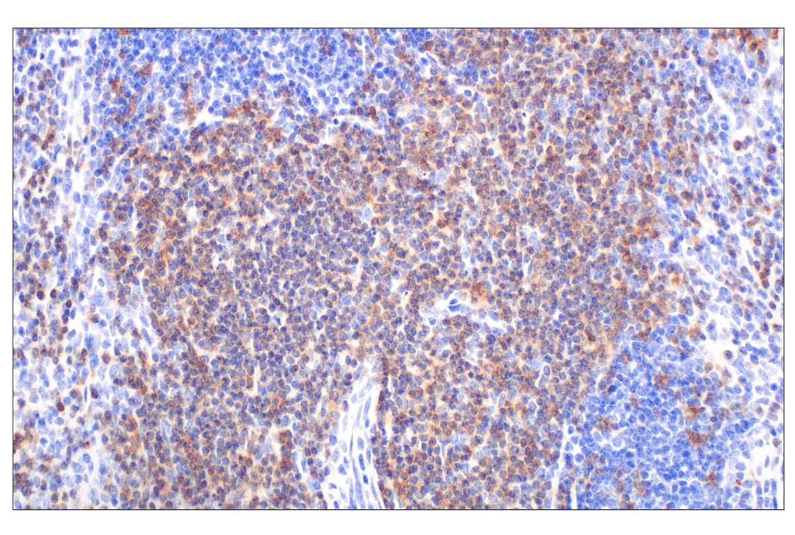 Immunohistochemistry Image 3: CD27 (F3R2V) Rabbit mAb