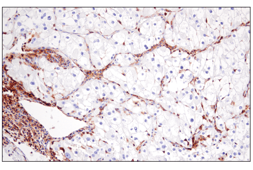 Immunohistochemistry Image 2: CD48 (D7L8I) XP<sup>®</sup> Rabbit mAb (BSA and Azide Free)