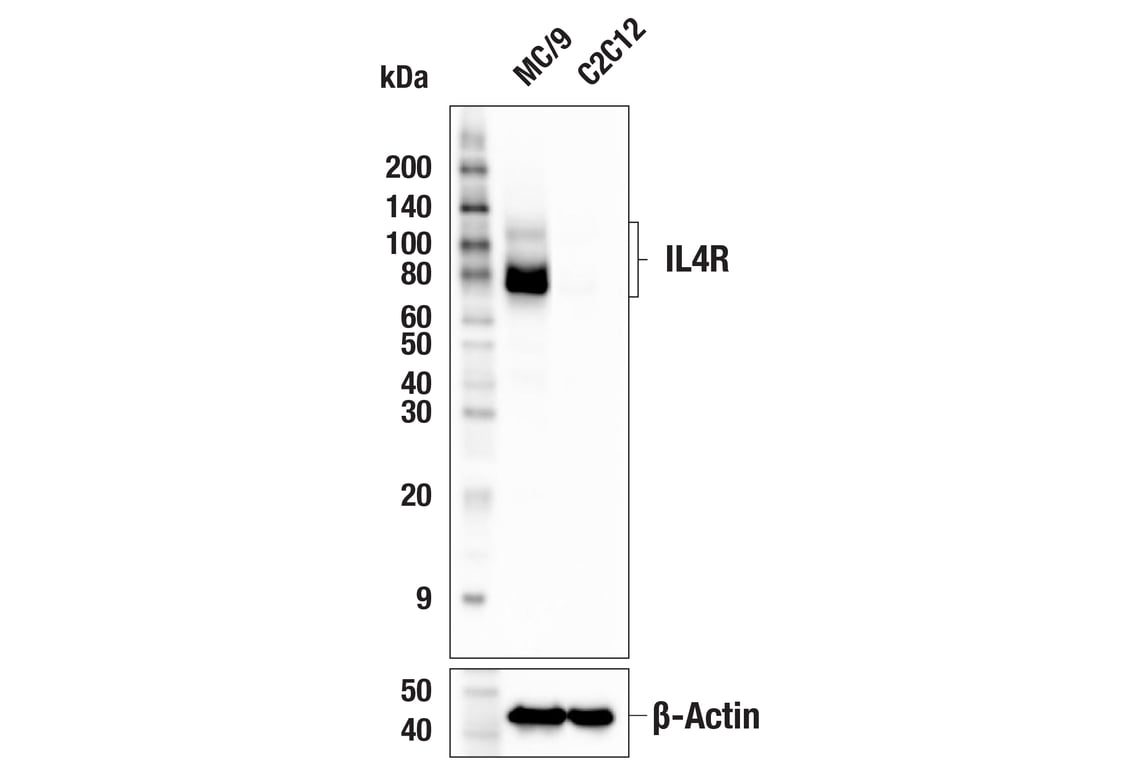Western Blotting Image 1: IL4R (F6C4Z) Rabbit mAb (BSA and Azide Free)