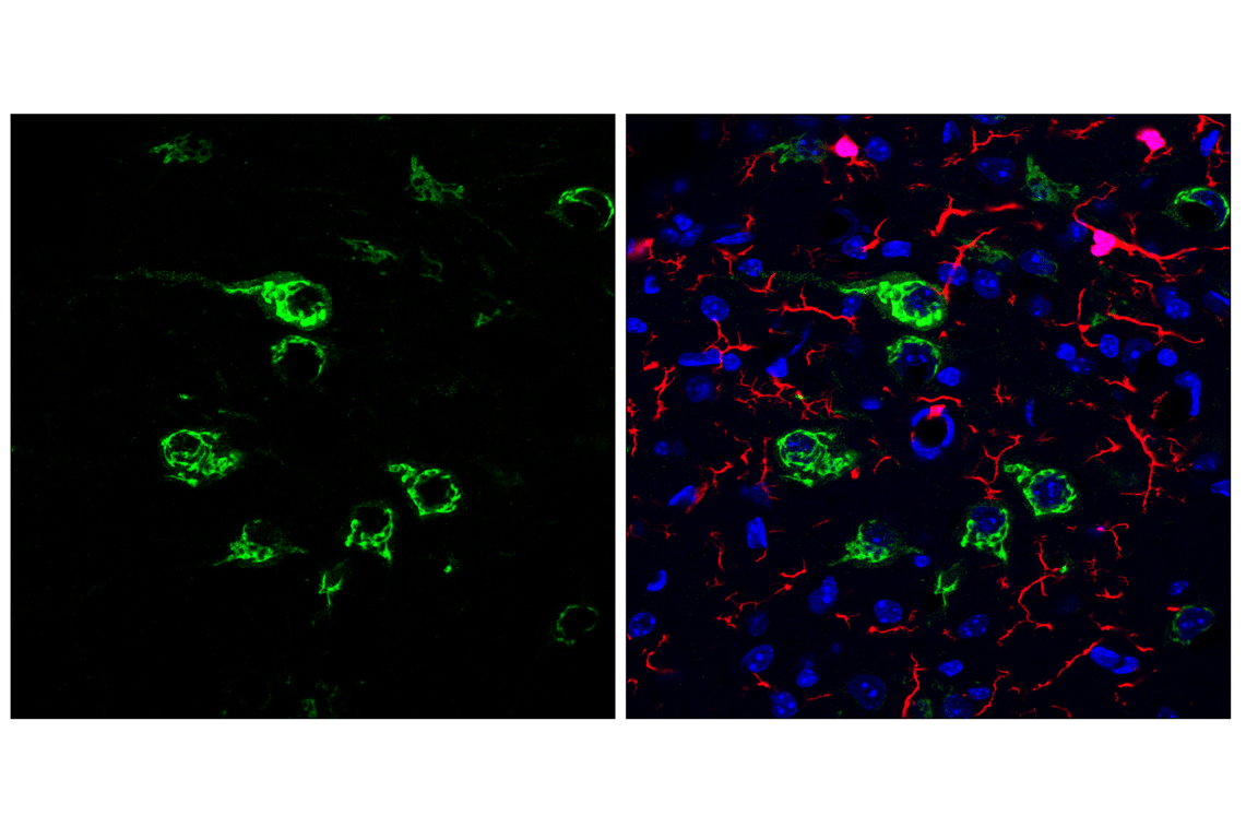 Immunofluorescence Image 3: Osteopontin/SPP1 (E9Z1D) Rabbit mAb (BSA and Azide Free)