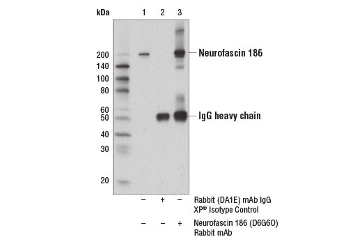 undefined Image 9: Demyelinating Disease Targets Antibody Sampler Kit