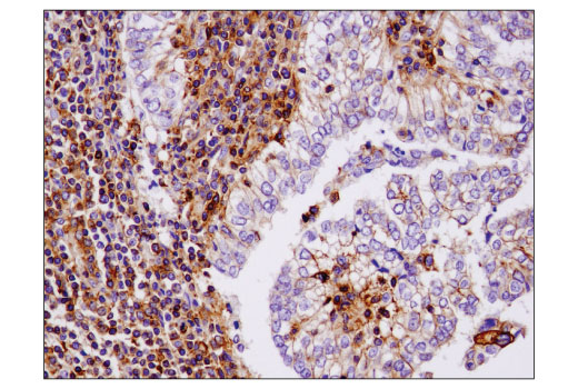 Immunohistochemistry Image 1: IQGAP1 (D8K4X) XP<sup>®</sup> Rabbit mAb