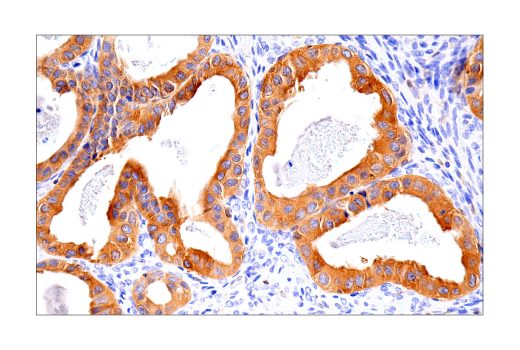 Immunohistochemistry Image 8: RIP3 (E7A7F) XP<sup>®</sup> Rabbit mAb