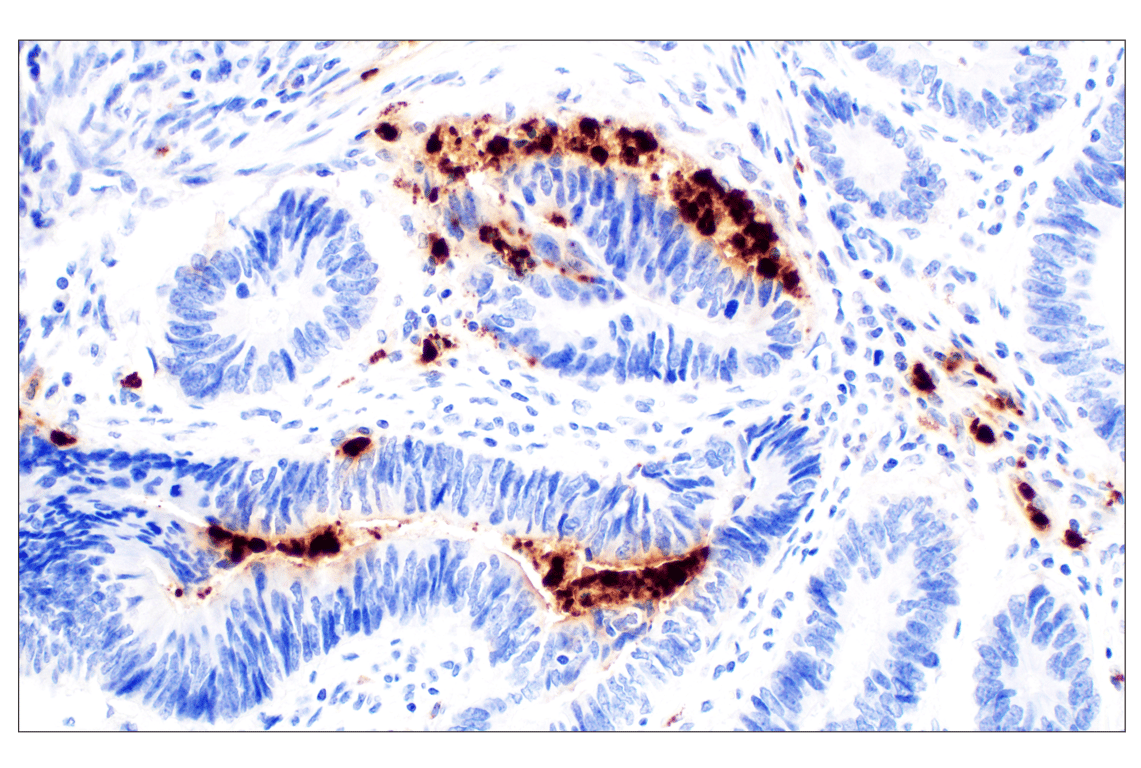 Immunohistochemistry Image 1: Neutrophil Elastase (F4H3X) Rabbit mAb (BSA and Azide Free)