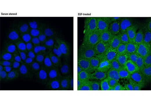 undefined Image 40: Angiogenesis Antibody Sampler Kit
