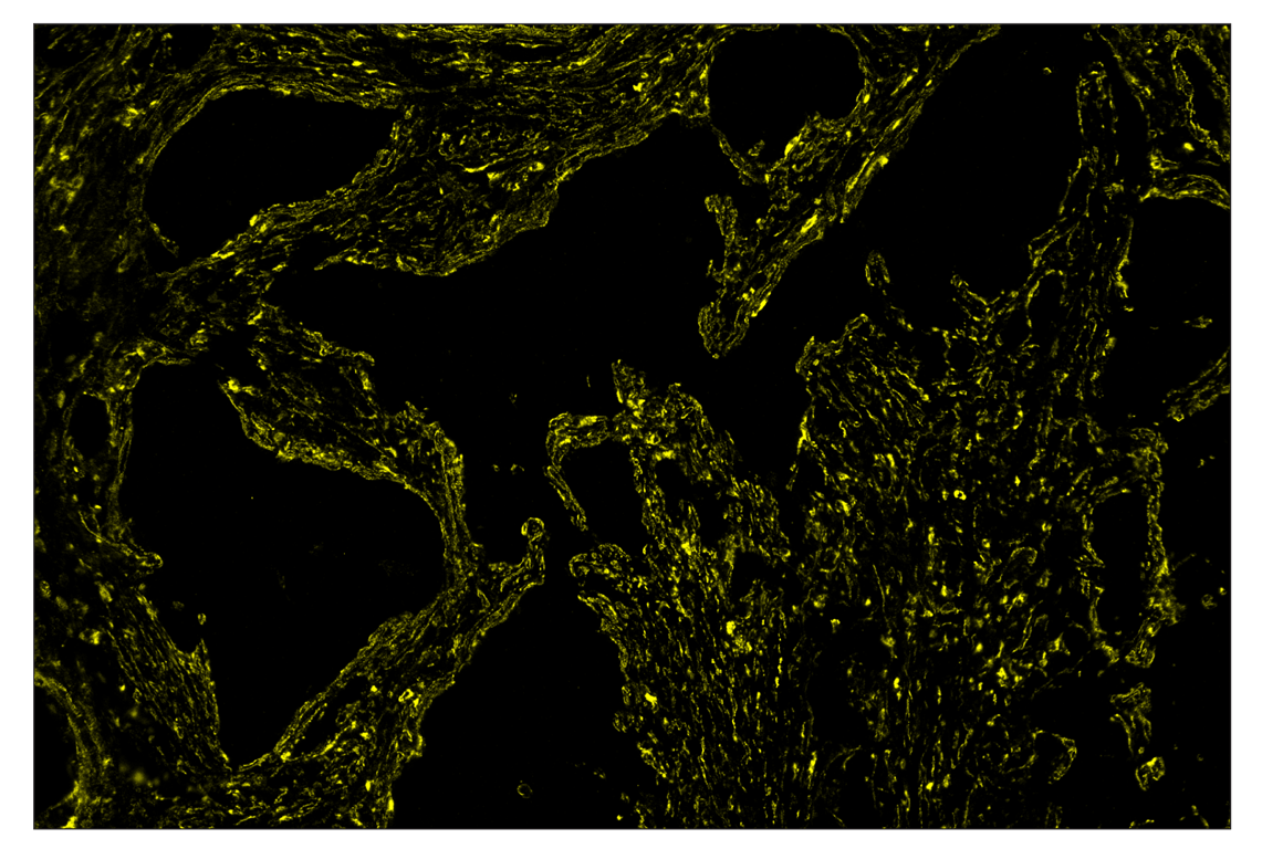 Immunohistochemistry Image 3: α-Smooth Muscle Actin (D4K9N) & CO-0024-488 SignalStar<sup>™</sup> Oligo-Antibody Pair