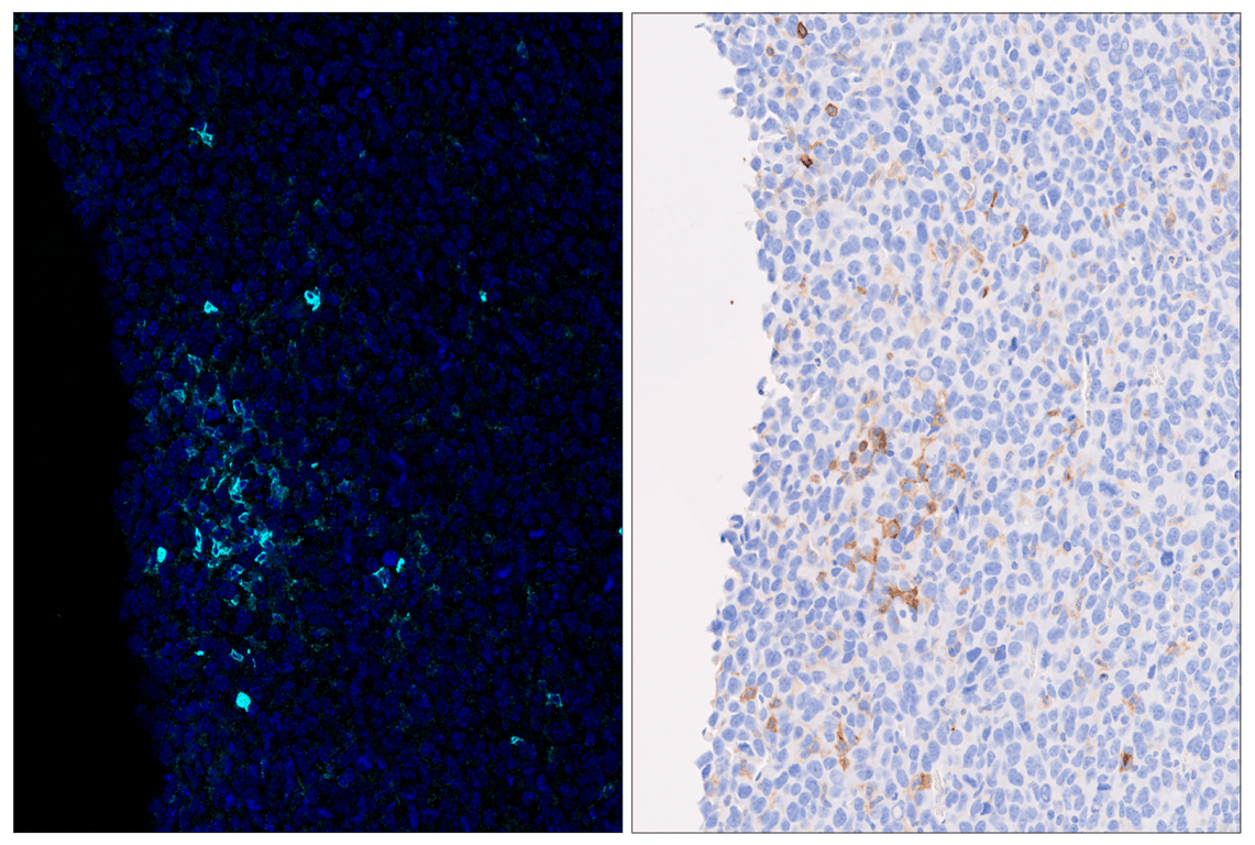 Immunohistochemistry Image 6: CD86 (E5W6H) & CO-0051-647 SignalStar<sup>™</sup> Oligo-Antibody Pair