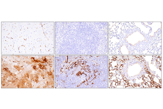 undefined Image 36: SARS-CoV-2 Virus-Host Interaction Antibody Sampler Kit