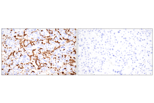 Immunohistochemistry Image 18: p22phox (E7Y1F) XP<sup>®</sup> Rabbit mAb