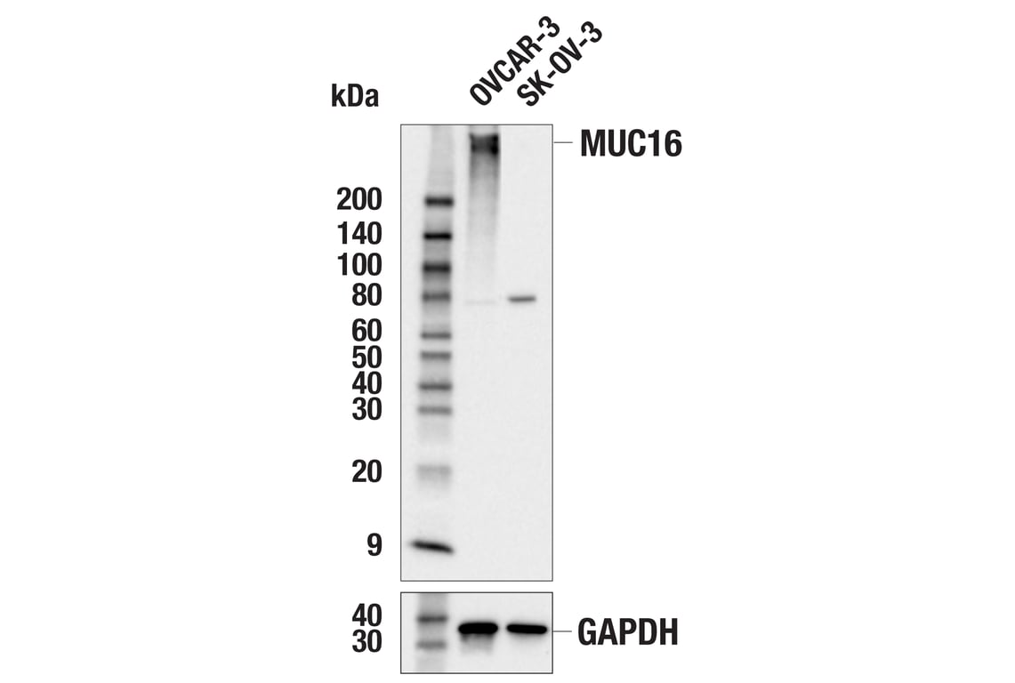 Western Blotting Image 1: MUC16 (E9E1Z) Rabbit mAb