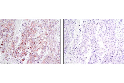 Immunohistochemistry Image 2: DDR1 (D1G6) XP<sup>®</sup> Rabbit mAb