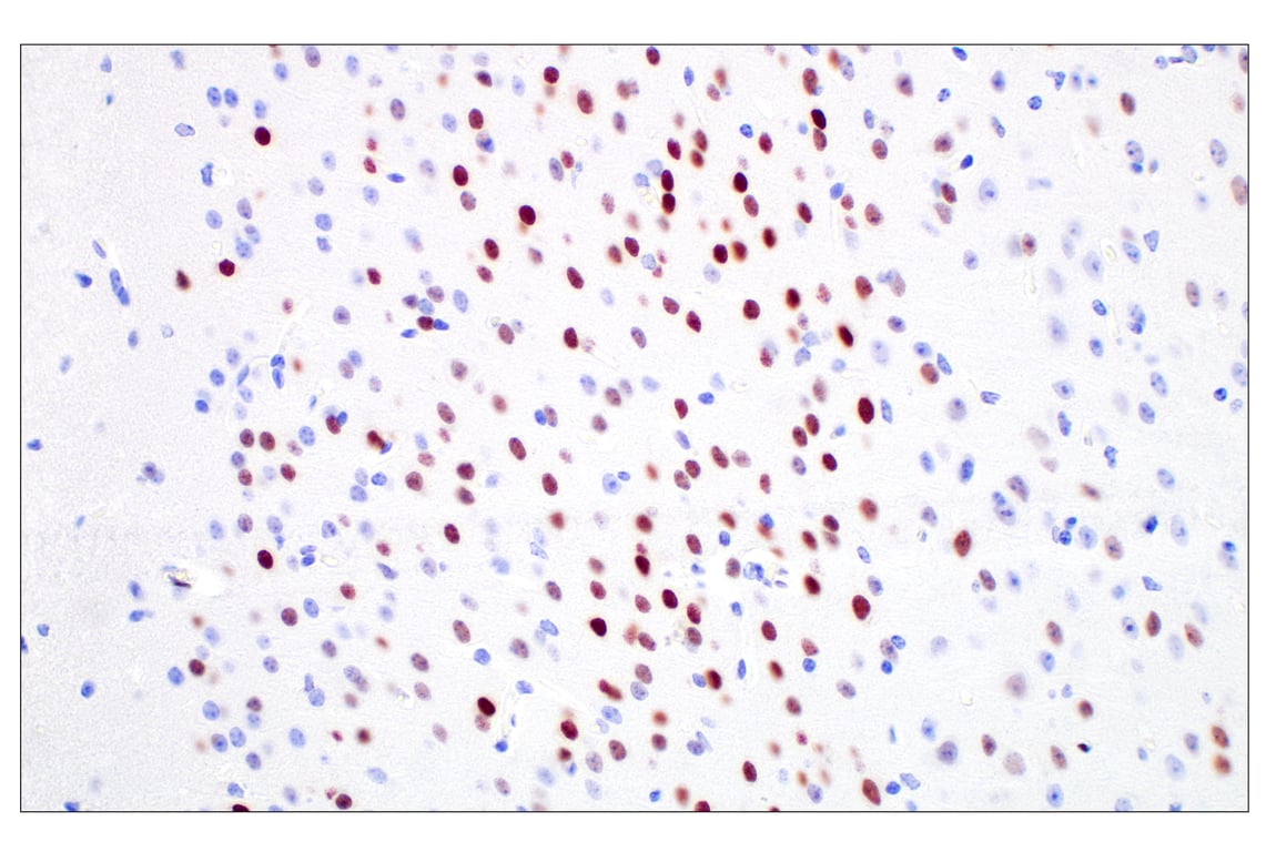 Immunohistochemistry Image 9: c-Fos (E2I7R) XP<sup>®</sup> Rabbit mAb