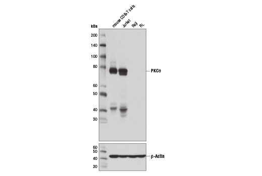Western Blotting Image 2: PKCθ (E1I7Y) Rabbit mAb (BSA and Azide Free)