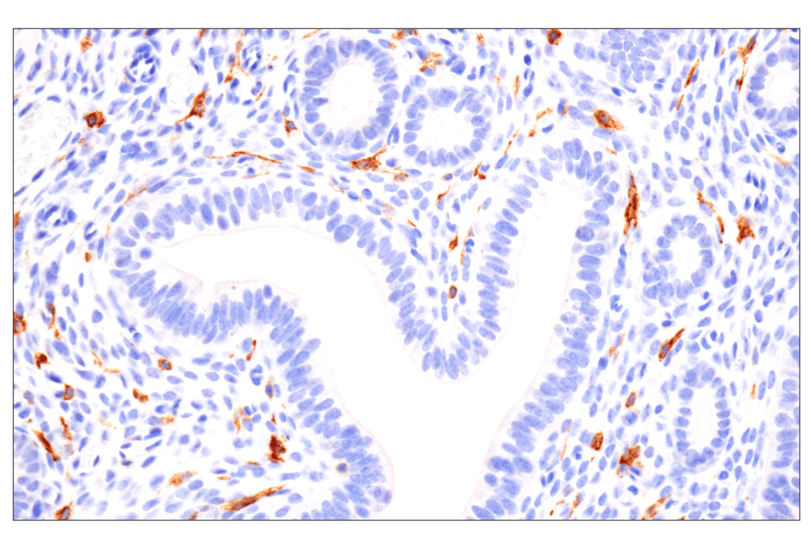 Immunohistochemistry Image 3: CD22 (F9D1W) Rabbit mAb (BSA and Azide Free)