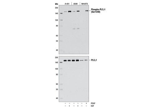 undefined Image 16: Angiogenesis Antibody Sampler Kit