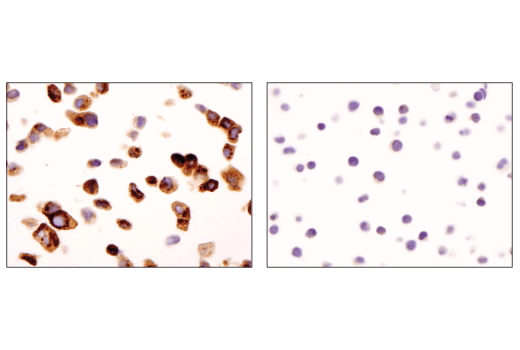 Immunohistochemistry Image 1: Clusterin (D7N2K) XP<sup>®</sup> Rabbit mAb