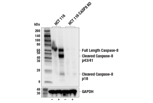 undefined Image 20: Apoptosis Antibody Sampler Kit II