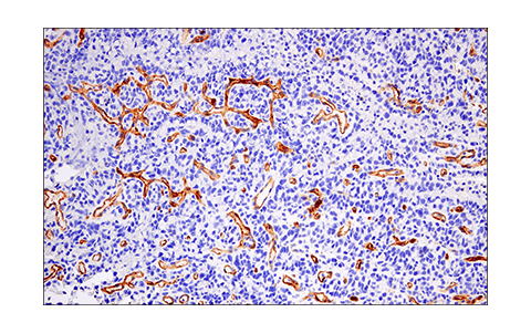 Immunohistochemistry Image 1: CD200 (E5I9V) XP<sup>®</sup> Rabbit mAb (BSA and Azide Free)