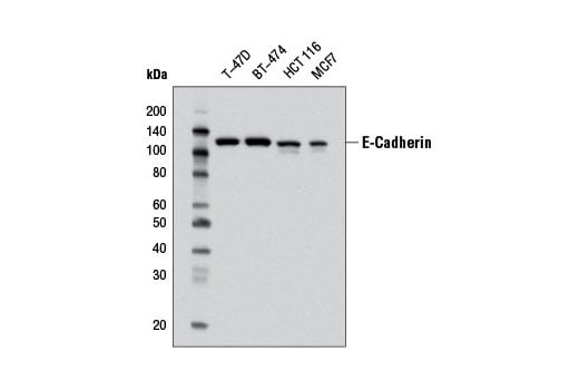 Western Blotting Image 1: E-Cadherin (32A8) Mouse mAb