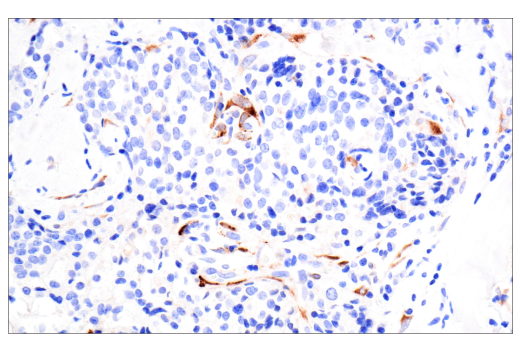 Immunohistochemistry Image 2: TIMP1 (D10E6) Rabbit mAb (BSA and Azide Free)