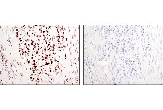 Immunohistochemistry Image 1: Di-Methyl-Histone H3 (Lys36) (C75H12) Rabbit mAb