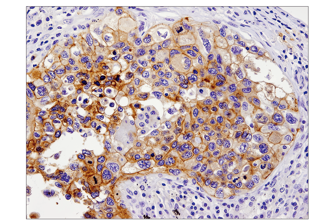 Immunohistochemistry Image 1: PD-L1 (E1L3N<sup>®</sup>) XP<sup>®</sup> Rabbit mAb (BSA and Azide Free)