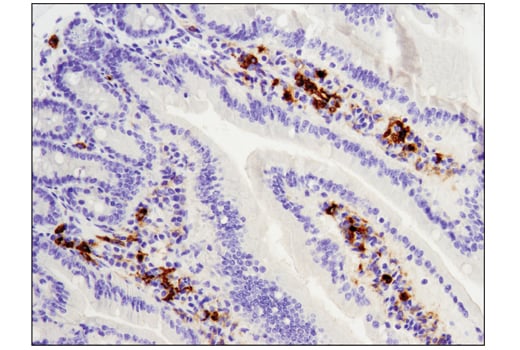 Immunohistochemistry Image 1: TIM-3 (D3M9R) XP<sup>®</sup> Rabbit mAb