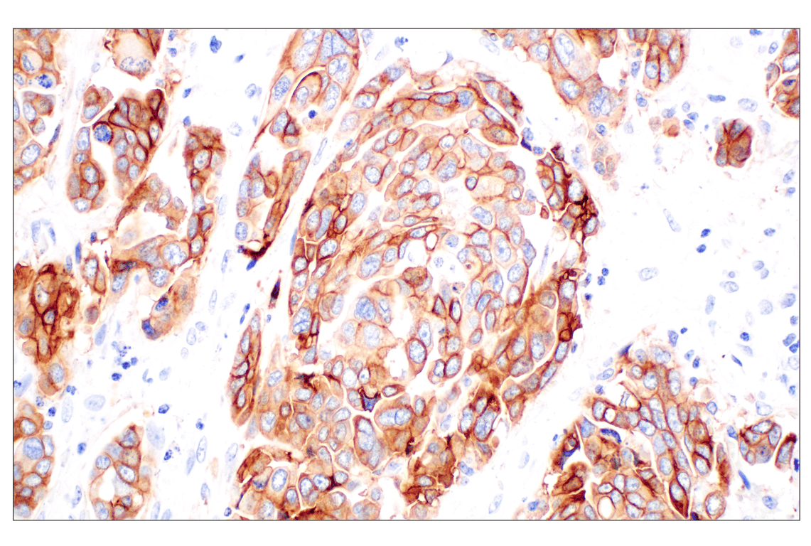 Immunohistochemistry Image 4: TACSTD2/TROP2 (F4W4J) Rabbit mAb (BSA and Azide Free)