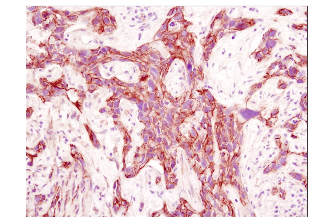Immunohistochemistry Image 3: β-Catenin (D10A8) XP<sup>®</sup> Rabbit mAb (BSA and Azide Free)