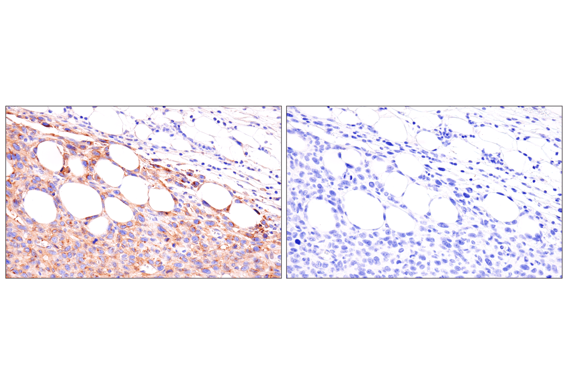 Immunohistochemistry Image 7: Axl (E3Z2H) Rabbit mAb (BSA and Azide Free)