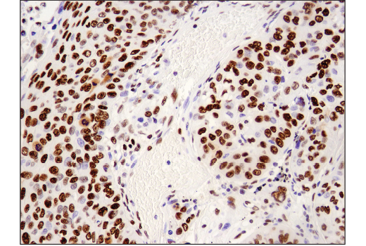 undefined Image 29: BAF Complex IHC Antibody Sampler Kit