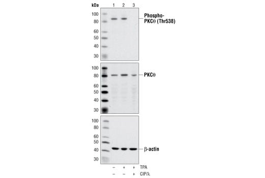 Western Blotting Image 1: Phospho-PKCθ (Thr538) Antibody