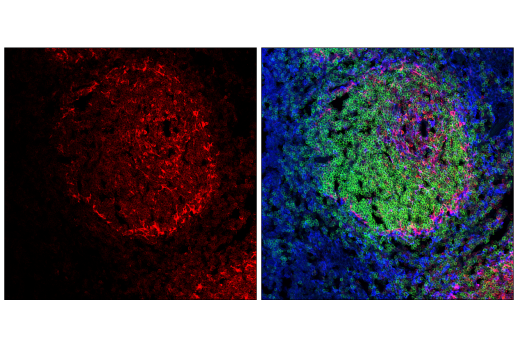 Immunofluorescence Image 1: STING (E9X7F) Rabbit mAb (Alexa Fluor<sup>®</sup> 647 Conjugate)