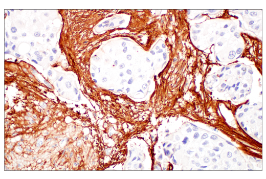 Immunohistochemistry Image 4: COL3A1 (E8D7R) XP<sup>®</sup> Rabbit mAb (BSA and Azide Free)