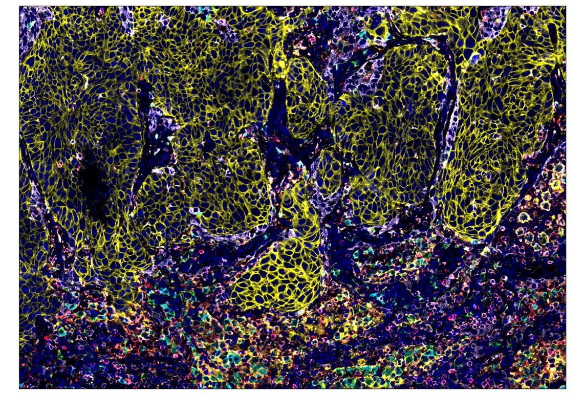 Immunohistochemistry Image 1: CD11c (D3V1E) & CO-0017-647 SignalStar™ Oligo-Antibody Pair