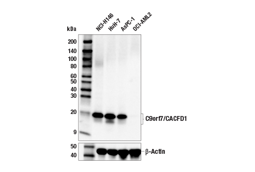 Western Blotting Image 1: C9orf7/CACFD1 (E6E3J) Rabbit mAb
