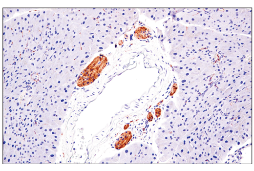 Immunohistochemistry Image 6: Enolase-2 (E2H9X) XP<sup>®</sup> Rabbit mAb